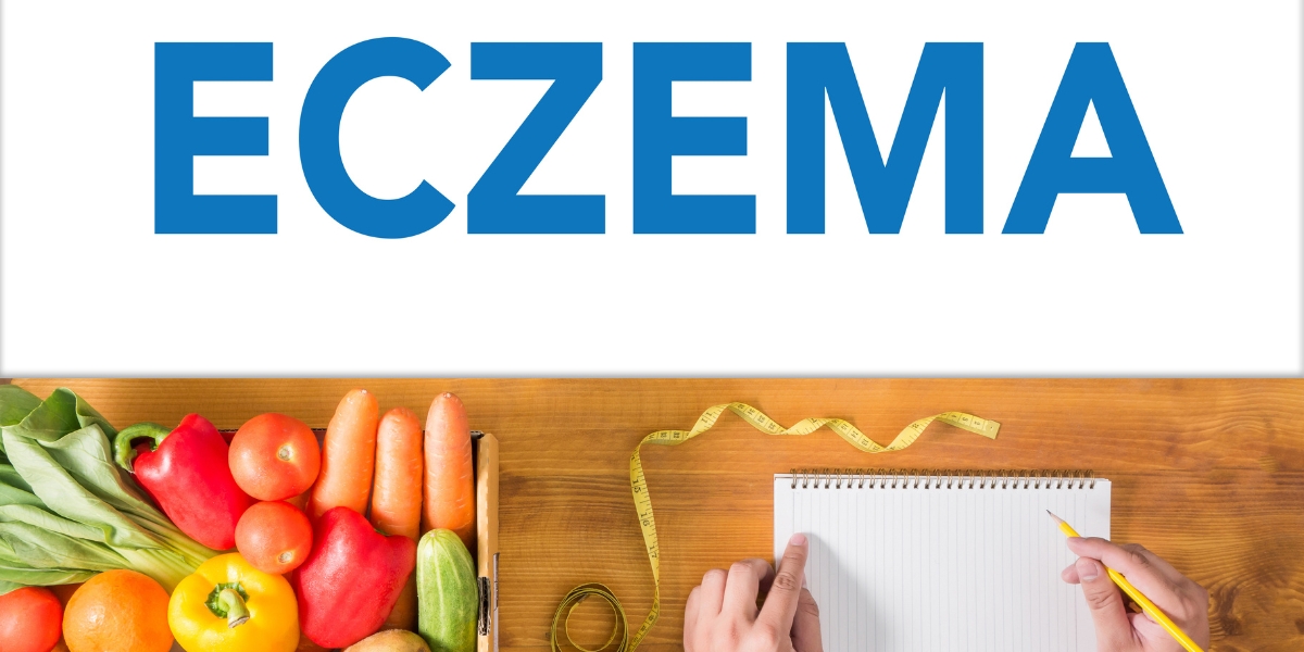 The Rise of Natural Remedies Exploring Holistic Approaches to Eczema - Branch brook Pharmacy