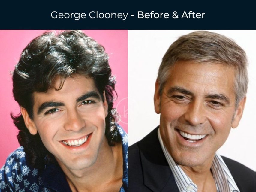 George Clooney: promoting dental health